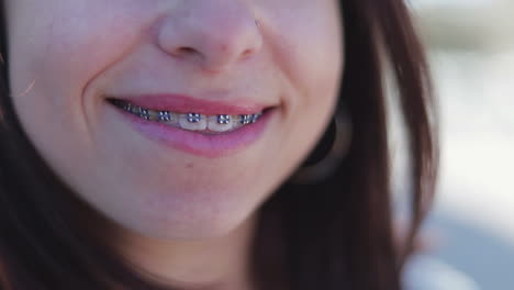 Offenes-Lächeln-Eines-Jungen-Mädchens-Mit-Zahnspange